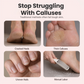 ⏳Flash Sale 50% Discount | Rechargeable Electric Foot Grinder Remove Hard Dead Skin Effortlessly