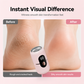 ⏳Flash Sale 50% Discount | Rechargeable Electric Foot Grinder Remove Hard Dead Skin Effortlessly