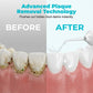 Portable Cordless Water Flosser for Teeth