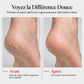 Waterproof Electric Foot Callus Remover with Red and Blue Light Care and Hydrating Spray